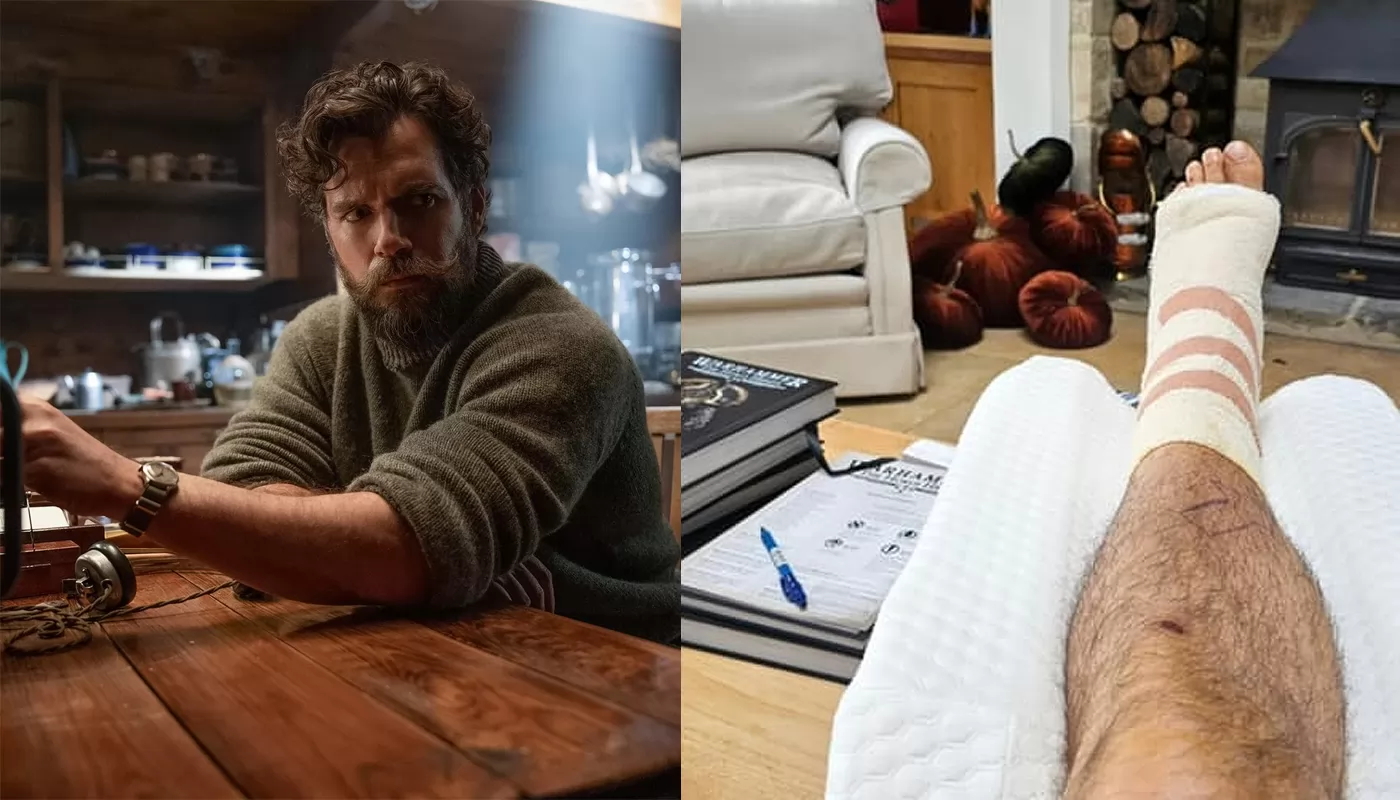 Генри Кавилл показал травму со съемок новой версии Горца