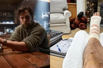 Генри Кавилл показал травму со съемок новой версии "Горца"